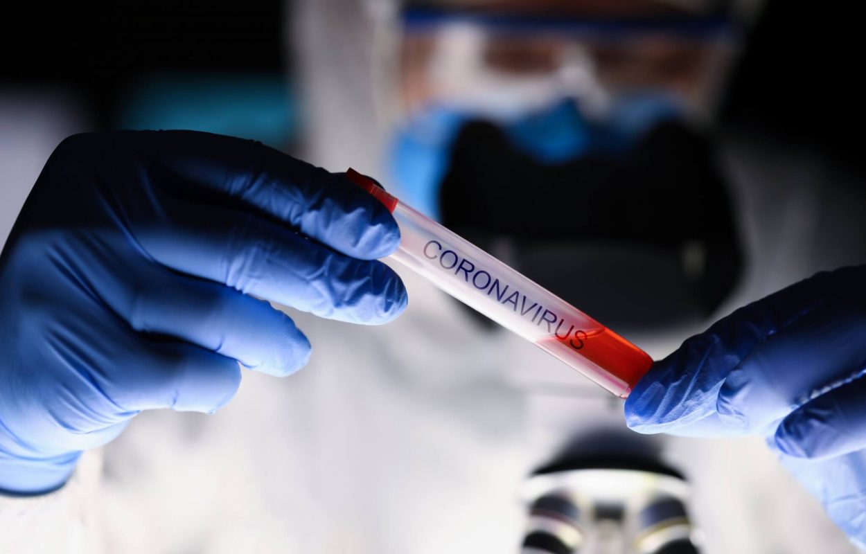 Coronavirus-scaled-1